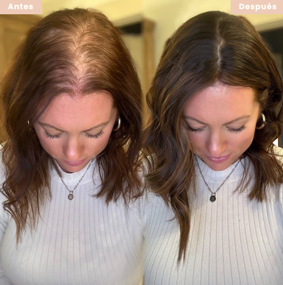 Hair Growth® – Cabello Más Largo, Fuerte y Hermoso Desde la Raíz